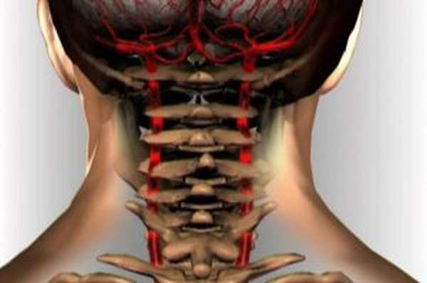 На что влияет остеохондроз шейного отдела позвоночника?